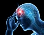 9 Effective Tips on How to Prevent Migraine Headaches cover picture