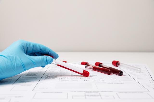 Understanding the Thyroid Profile Blood Test: What You Need To Know cover picture
