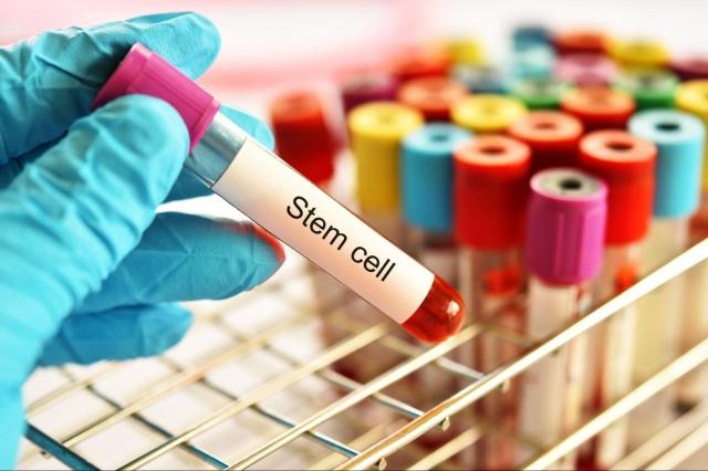 How Regenerative Medicine and Stem Cell Therapy in Chicago Are Helping People Live More Positively and Pain-Free cover picture