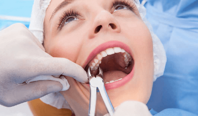 How Long After Having a Tooth Pulled Can You Smoke? cover picture