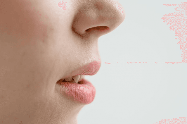 Everything You Need to Know About Lip Reduction Surgery cover picture