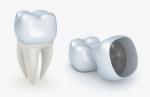 What to Expect When Getting a Dental Crown cover picture
