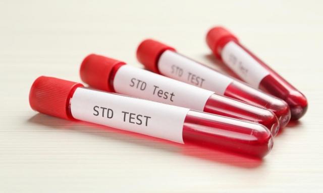 7 Myths About STD Testing That Should Be Addressed ASAP cover picture