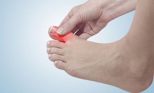 4 Conservative Treatments for Hallux Limitus and Hallux Rigidus cover picture