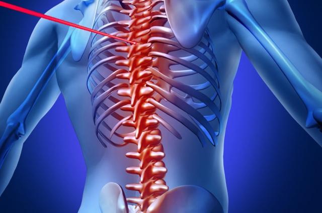 5 Common Conditions That Can Be Treated Through Laser Spine Surgery cover picture
