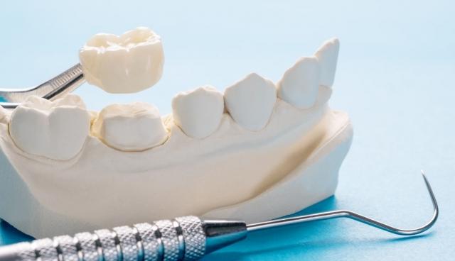 5 Debunked Myths About Dental Crowns cover picture