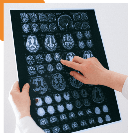 Unlocking the Power of Data-Driven Healthcare for Optimal Brain Functioning cover picture