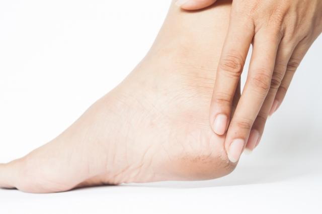 Home Remedies for Cracked Heels cover picture