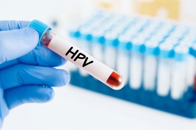 Basics of HPV Testing for Filipinos: Informative Insights cover picture