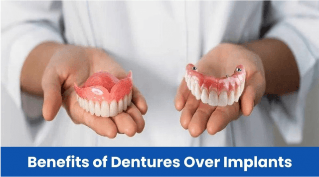 A Condensed Article on the Unique Benefits of Dentures over Implants cover picture