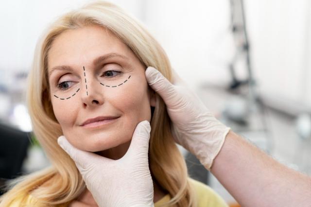Blepharoplasty: Rejuvenating Your Eyes and Enhancing Your Vision cover picture