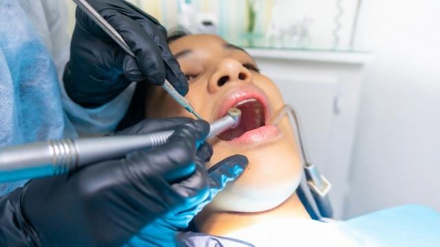 Tooth Extraction: Everything You Need To Know cover picture