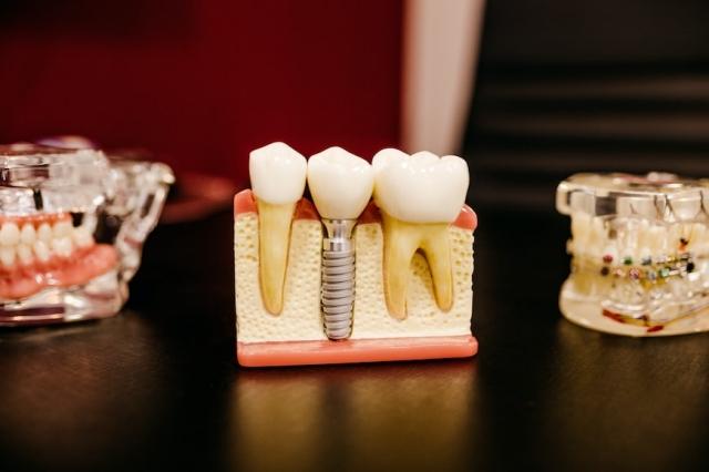 Exploring the Impact of Oral Health on Overall Wellbeing cover picture