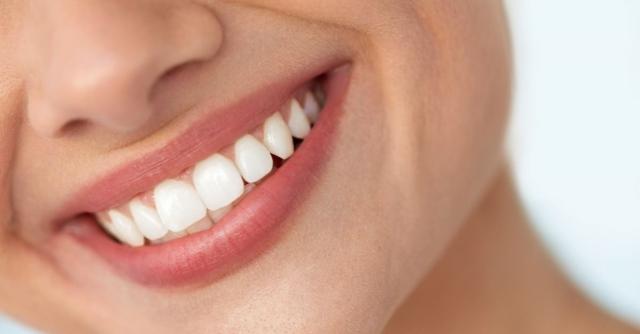 The Top Foods To Avoid To Have White Teeth cover picture