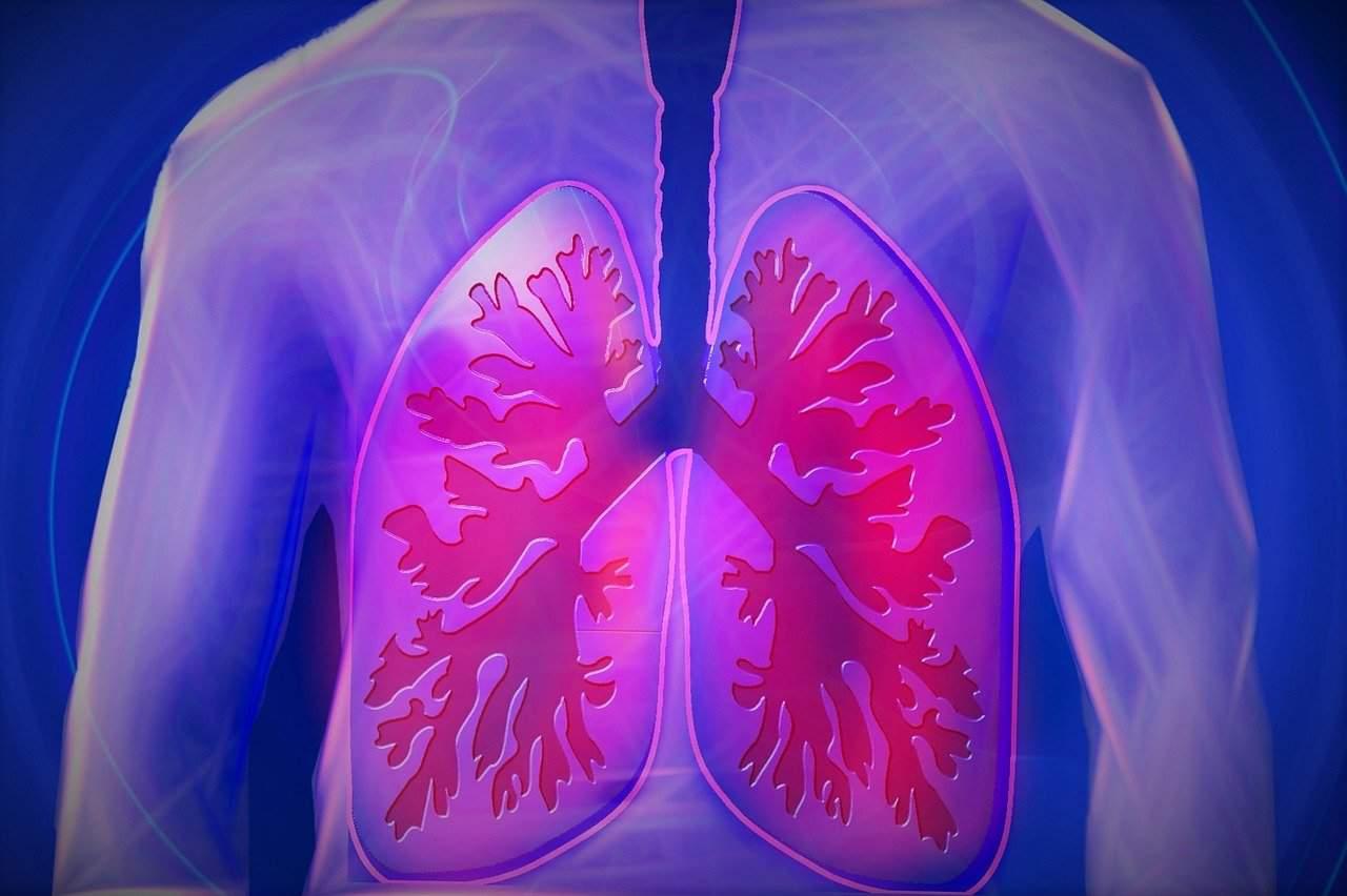 All About Lung Cancer; Symptoms, Causes, and different Treatments cover picture