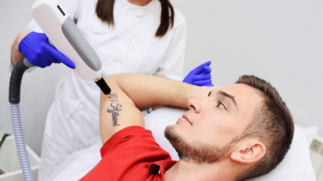 Clean Slate: The Science Behind Laser Tattoo Removal in Dubai