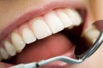 Nano Whitening Technology for the Perfect Smile
