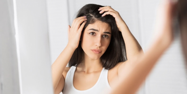 Dandruff Treatment Without Chemicals: Natural Solutions You Must Try