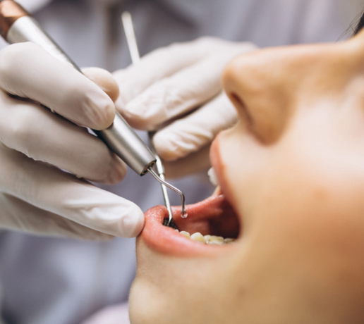 Root Canal Treatment in Borivali West: Best Clinics & Cost Guide