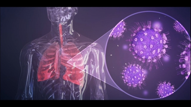 Influenza Therapeutics: Understanding Treatment Options for the Flu
