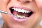 Exploring the Impact of Dental Appliances on Your Smile