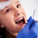 The Benefits of Adult Orthodontics: It’s Never Too Late for a Perfect Smile