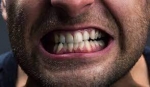The Ultimate Guide to Treating Teeth Grinding