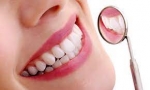 Comprehensive Care for Your Smile with Full Mouth Rehabilitation