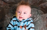 Menkes Disease Market is Estimated to Witness High Growth Owing to Rising Awareness About Rare Diseases