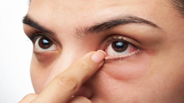 Diabetic Retinopathy Increasingly Common in Younger People