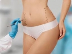 Top Clinics for Tummy Tuck Surgery in Dubai