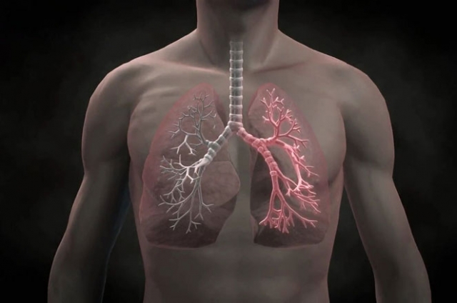 Emphysema Market: Leading Causes and the Impact on Healthcare Systems