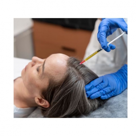 Why Consider Hair Transplantation For Women?
