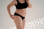 Toned Body with Liposuction in Dubai
