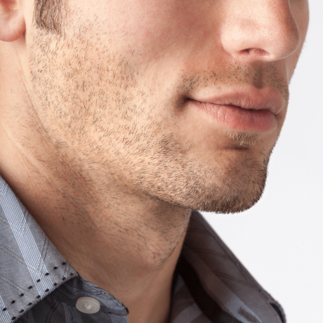 Achieve a Chiseled Look for Men with Jawline Filler