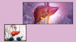 Best Pancreas Surgery Hospital in Jaipur — Advanced Treatment for Liver and Pancreatic Disorders