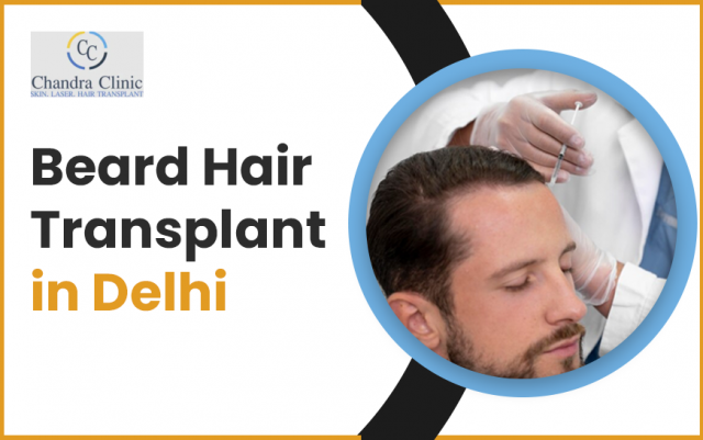 Get Beard Transplant for Beard Restoration and Natural Results