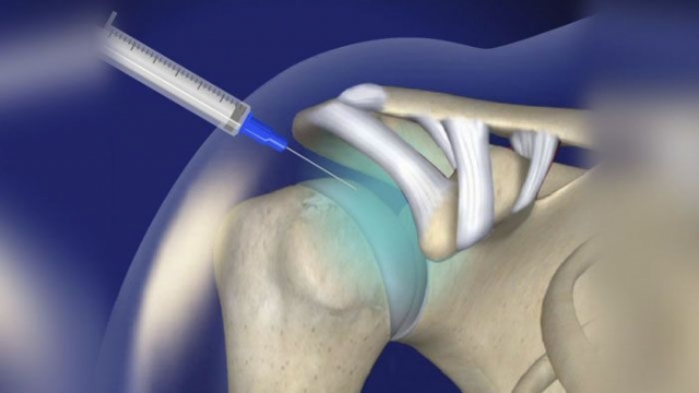 Joint Pain Injections Market is driven by rise in usage of combination therapies