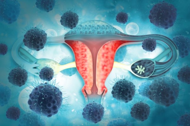 The Clear Cell Ovarian Cancer Market Set to Register High Growth due to Rising Incidence Rates of Ovarian Cancer