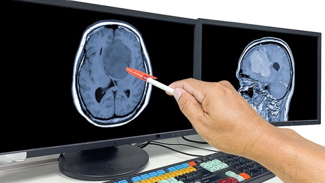 The Glioblastoma Market is Estimated to Witness High Growth Owing to Rising Geriatric Population