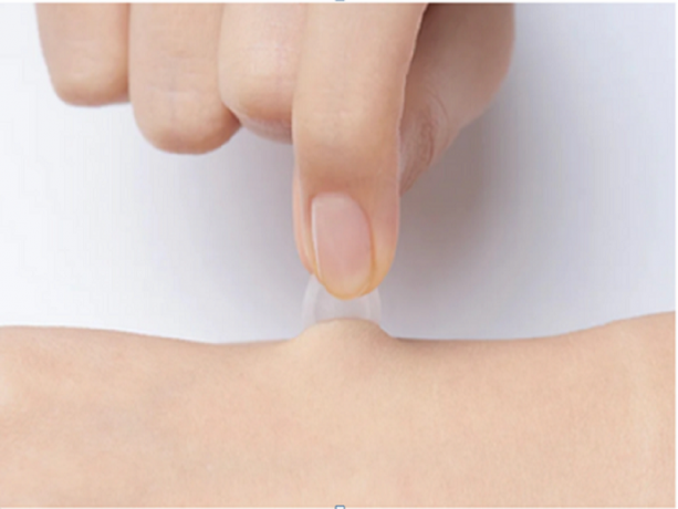 Can OEM Hydrocolloid Patches Help With Scars