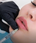 Natural-Looking Lip Filler Injections in Dubai: A Guide to Achieving Perfectly Enhanced Lips