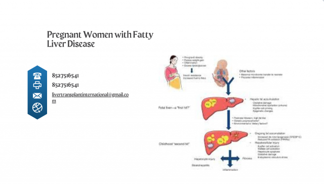 Pregnant Women with Fatty Liver Disease