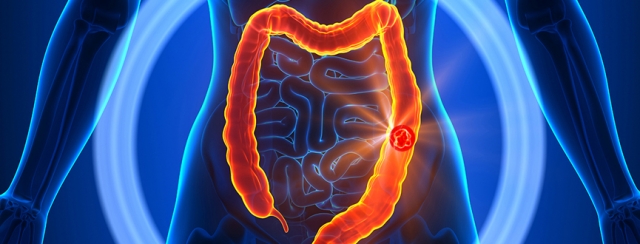 Best Colorectal Surgery in Dubai: How Advanced Techniques Are Redefining Treatment in 2025