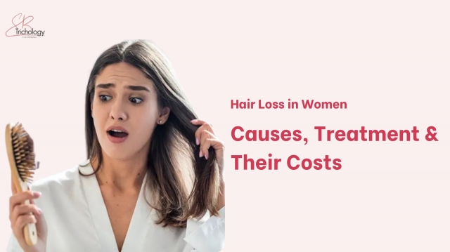 Hair Loss in Women: Causes, Treatment & Their Costs 