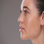 Will My Nose Look Natural After Rhinoplasty?