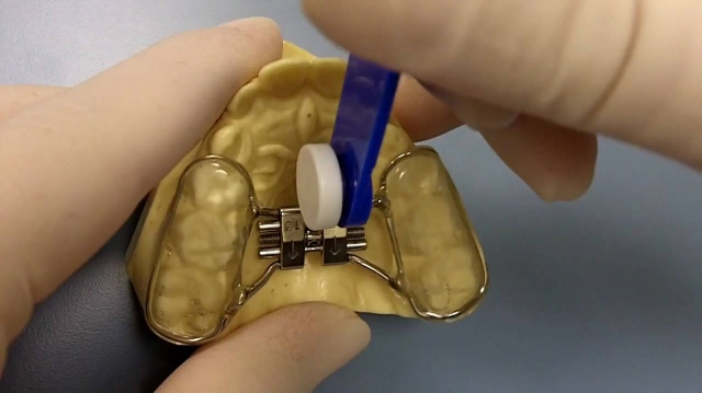 The Future of Orthodontics: How 3D Technology Is Changing the Industry