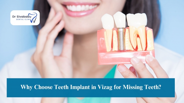 Why Choose Teeth Implant in Vizag for Missing Teeth?