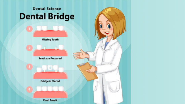 The Step-by-Step Process of Getting a Dental Bridge