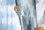 Meet Nagpur’s Joint-Saving Hero: Dr. Utsav Sir on Modern Knee & Hip Solutions